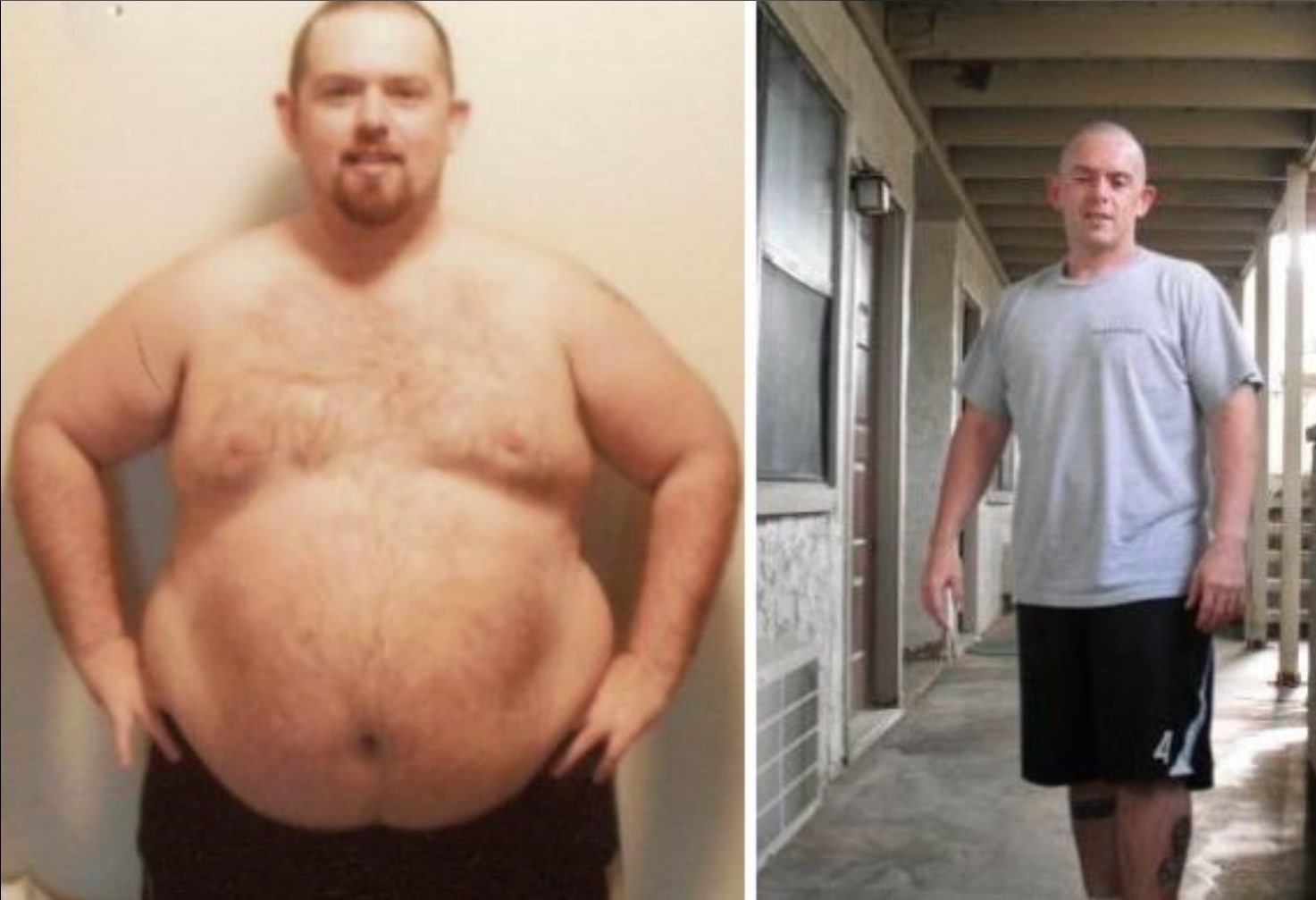 Мужчина после 32. Жирные люди после похудения. Толстяки до и после похудения.